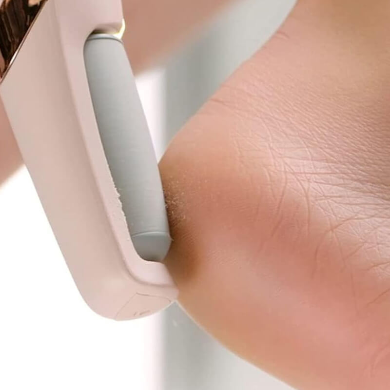 Electric Pedicure Foot File Callus Remover