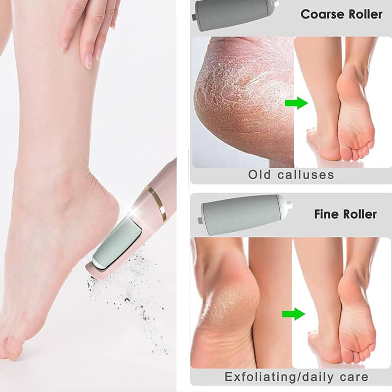 Electric Pedicure Foot File Callus Remover