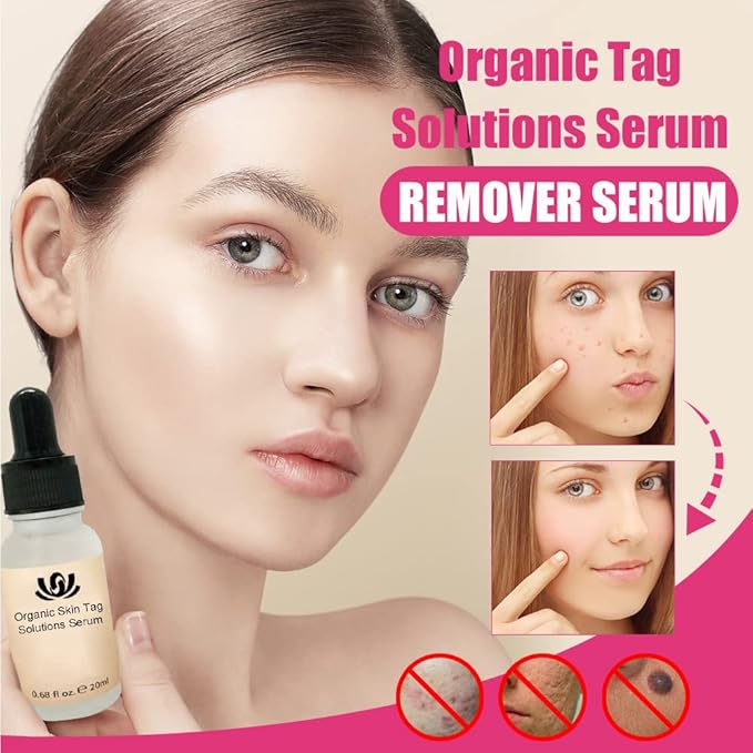 Organic Skin Tag Solutions Serum